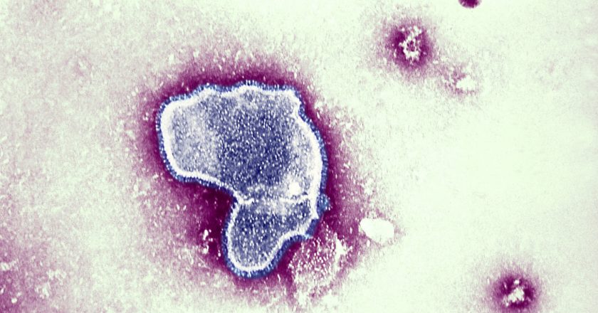 As Childrens COVID Cases Surge, Theres Another Virus On The Rise – NPR