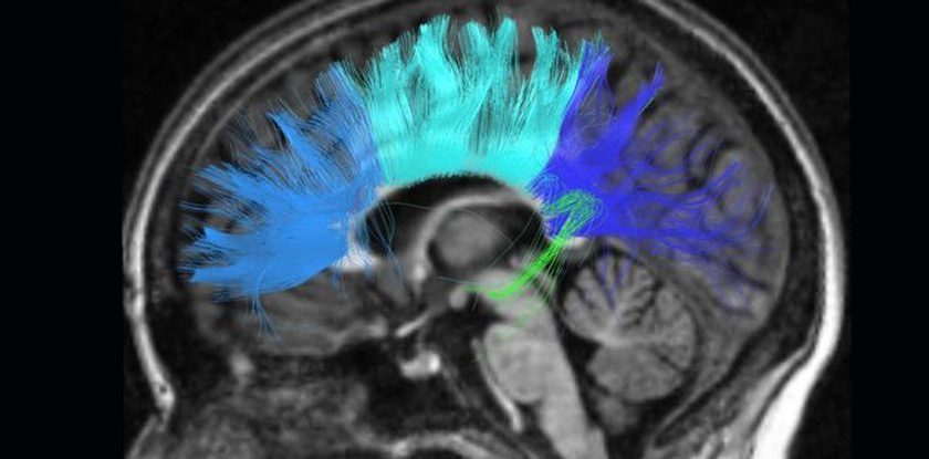 World-First Brain Implant Successfully Treats Resistant Depression in a Patient – ScienceAlert