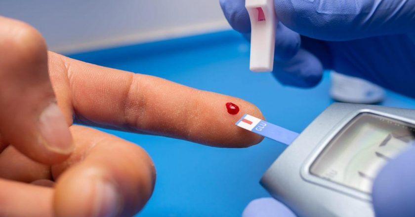 People are developing diabetes after COVID-19. It might be because the virus messing with insulin-producing cells, new research suggests. – Yahoo News