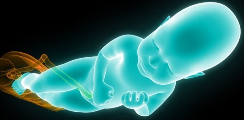 Human Birth Canals Are Seriously Twisted. Researchers Think Theyve Figured Out Why – ScienceAlert