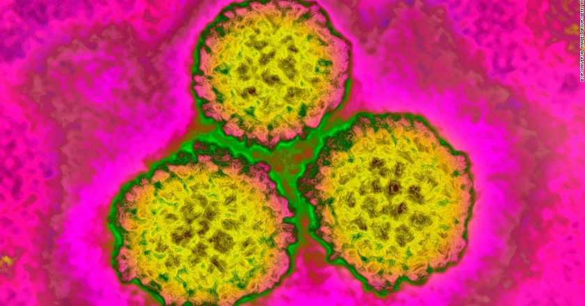 HPV vaccine reduced cervical cancer rates by 87% in women, UK study finds – CNN