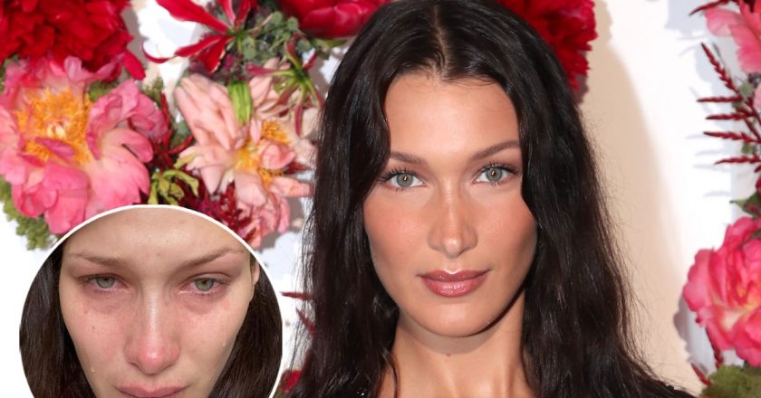 Bella Hadid Details Excruciating And Debilitating Mental Health Struggles – TooFab