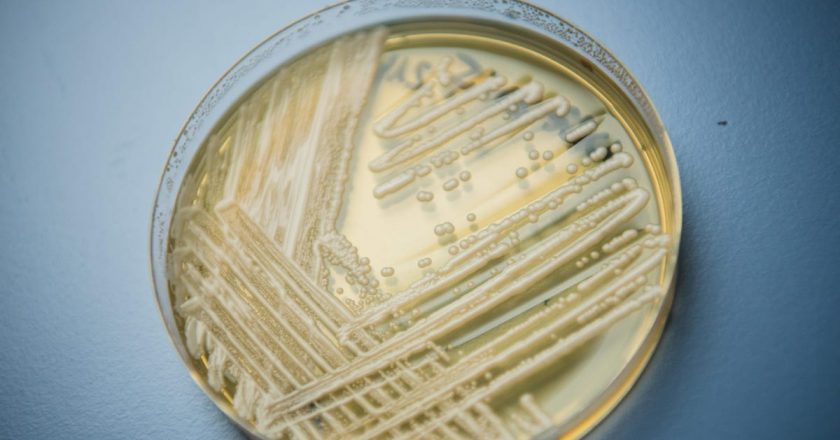 Louisiana Reports Its First Cases of C. Auris Superbug Fungus – Gizmodo