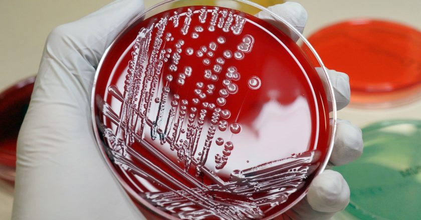 Antibiotic-resistant infections are a ‘major global health threat’ that’s killing millions, scientists say – CNBC