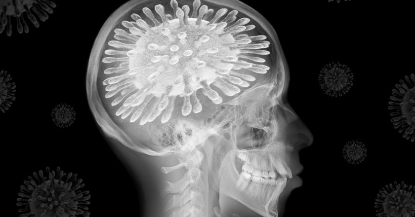 Post-COVID ‘brain fog’ could be result of virus changing patients’ spinal fluid – WJW FOX 8 News Cleveland