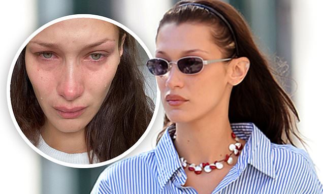 Bella Hadid speaks about her problems with alcohol and embracing sobriety during a candid interview – Daily Mail