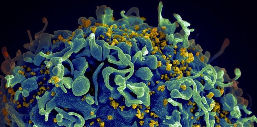 Cancer Drug Flushes Out Latent HIV, Exciting New Study Finds – ScienceAlert