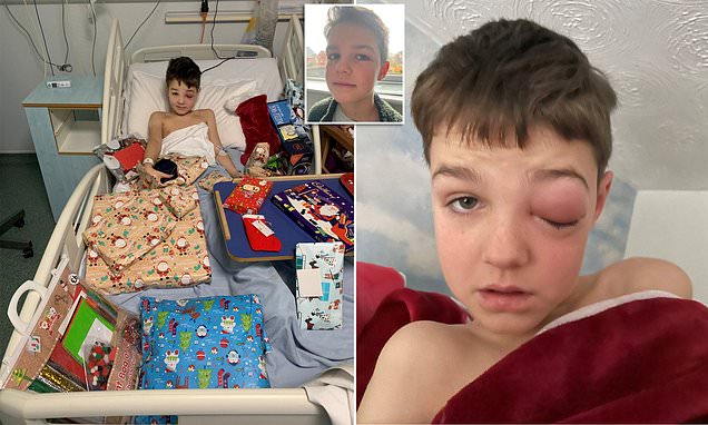 Boy, 9, almost went blind when he developed Covid-eye after testing positive for the virus – Daily Mail