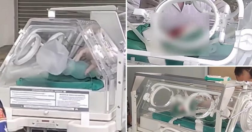 Brazilian stillborn baby being prepped for burial found to be alive – New York Post