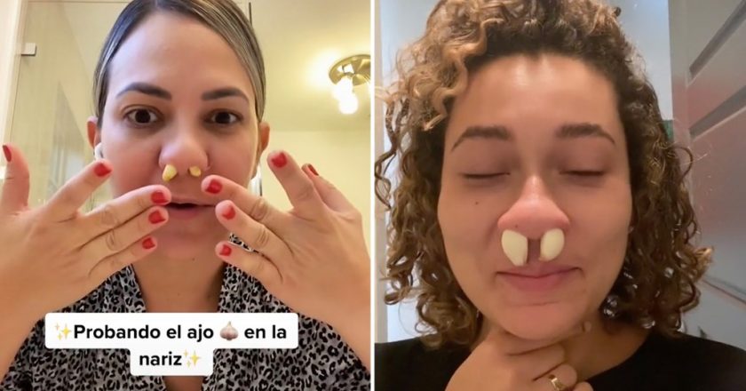 Gnarly garlic in nose TikTok trend makes stuffy noses worse: docs – New York Post