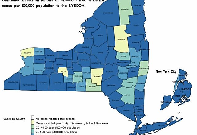 Widespread Flu Activity Now Reported In New York: Here Are Counties Most Affected – White Plains Daily Voice