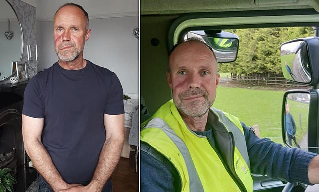 Manchester dad gets stage four tumour removed after visiting GP because water SPURTED from his nose – Daily Mail