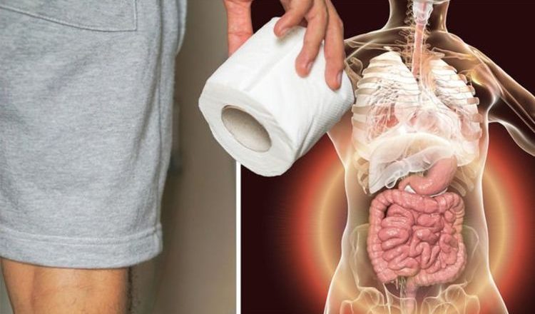 Cancer symptoms: Two signs to spot when going to the toilet – seen in 90% of patients – Express