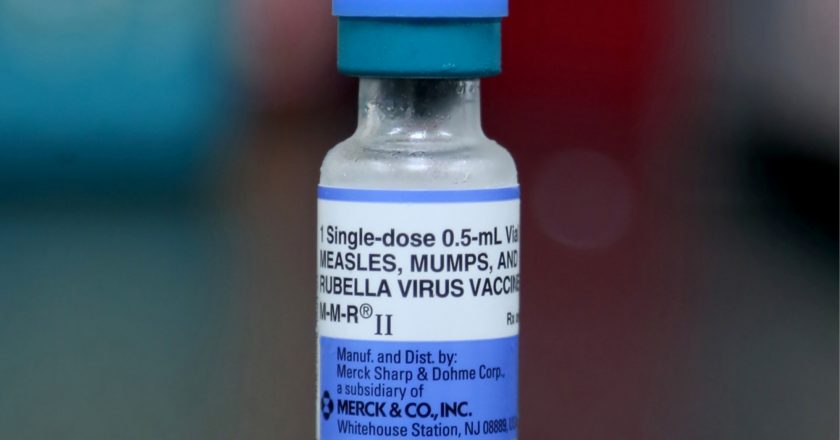 Measles case reported in Fairfax Co. – WTOP