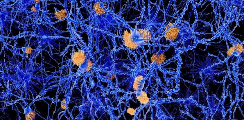 We Just Got Closer to Finding a Link Between Alzheimers And Circadian Rhythms – ScienceAlert