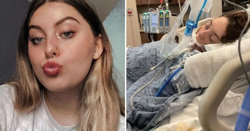 Teen goes on life support with lung damage — vaping habit to blame – New York Post