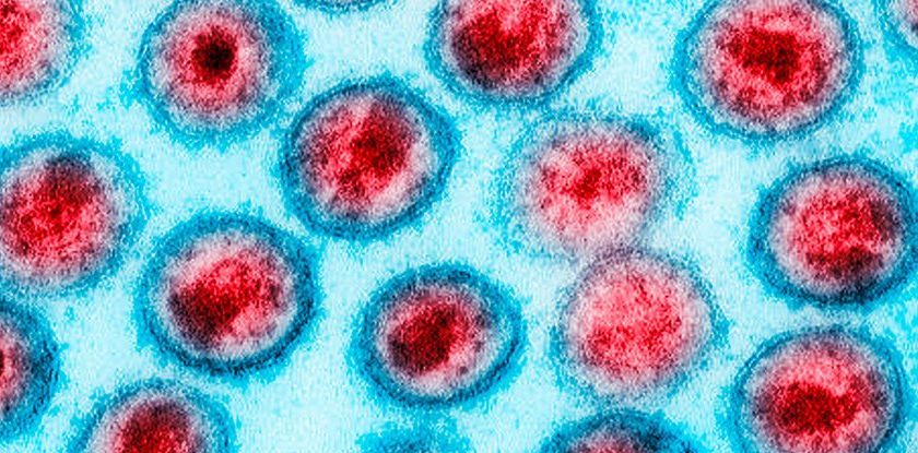 American Woman Appears to Be Entirely Cured of HIV After Unique Medical Treatment – ScienceAlert