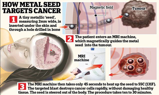 Magnetic balls that heat up and then blast away tumours – Daily Mail