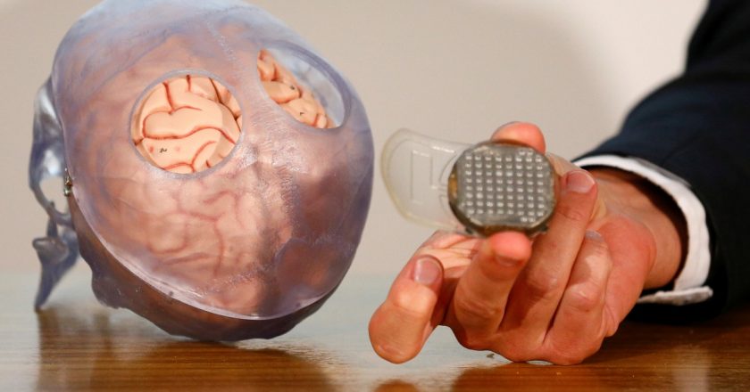 Brain implants allow fully paralysed man to communicate – Al Jazeera English