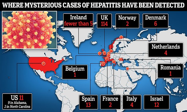 US cases of child hepatitis reach 11 with global toll hitting 169, including one death – Daily Mail