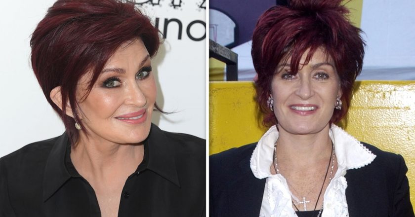 Sharon Osbourne Opens Up about Horrendous Facelift and Ketamine Therapy – TMZ