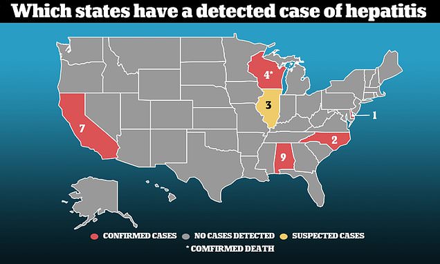 California declares seven cases of severe hepatitis after a child dies of suspected illness – Daily Mail