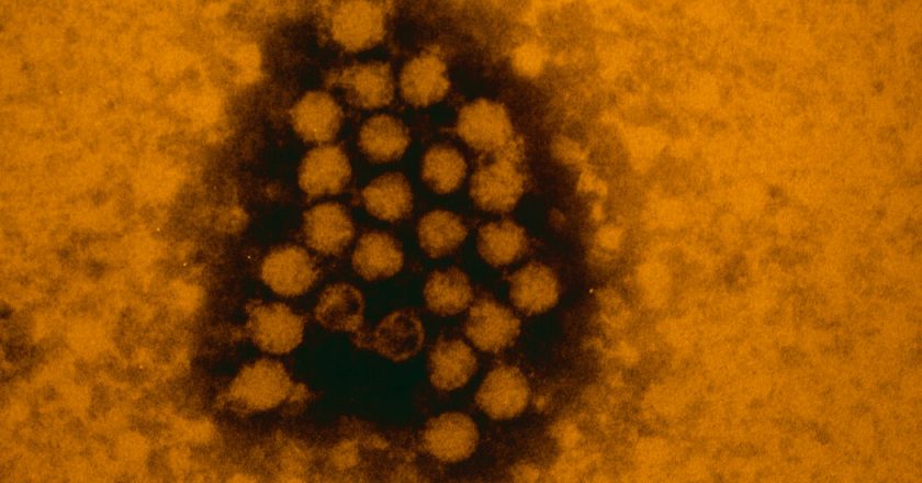 Why a Coronavirus-Flu ‘Twindemic’ May Never Happen – The New York Times