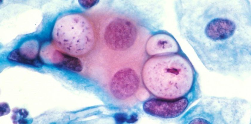 STDs in The US Are Dramatically Increasing, And Theres a Key Factor to Blame – ScienceAlert