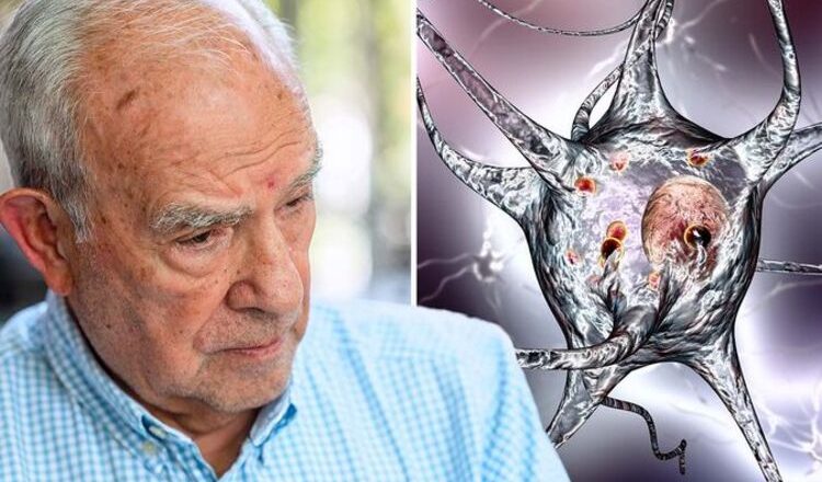 Dementia: The ‘early-stage’ symptoms of the brain condition – from mood to language – Express