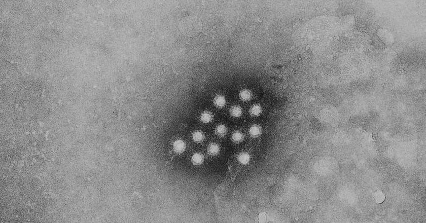 Mysterious hepatitis outbreak in kids reaches N.J. – NJ.com