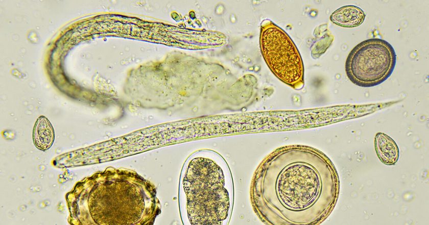 Most infectious parasite in the world may have already infected 50% of people – WKRC TV Cincinnati