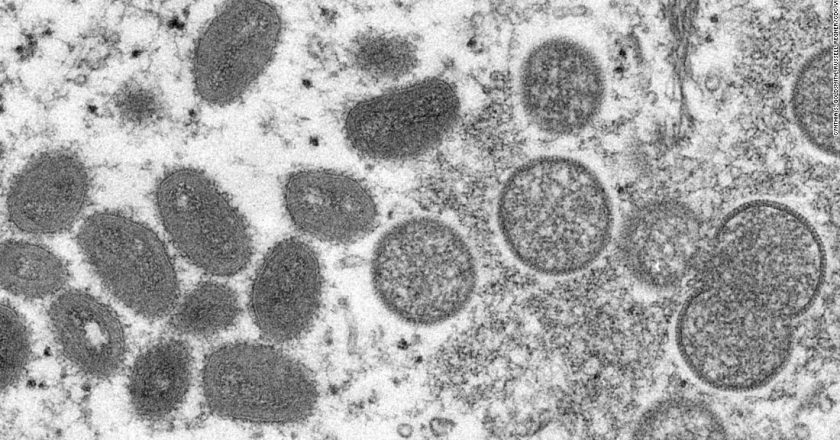 US in process of releasing monkeypox vaccine from national stockpile for high-risk people, CDC says – CNN