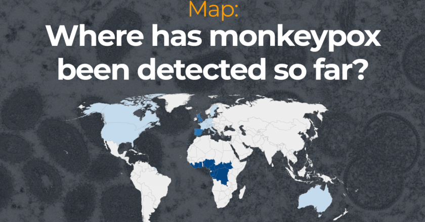 Map: Where has monkeypox been detected so far? – Al Jazeera English