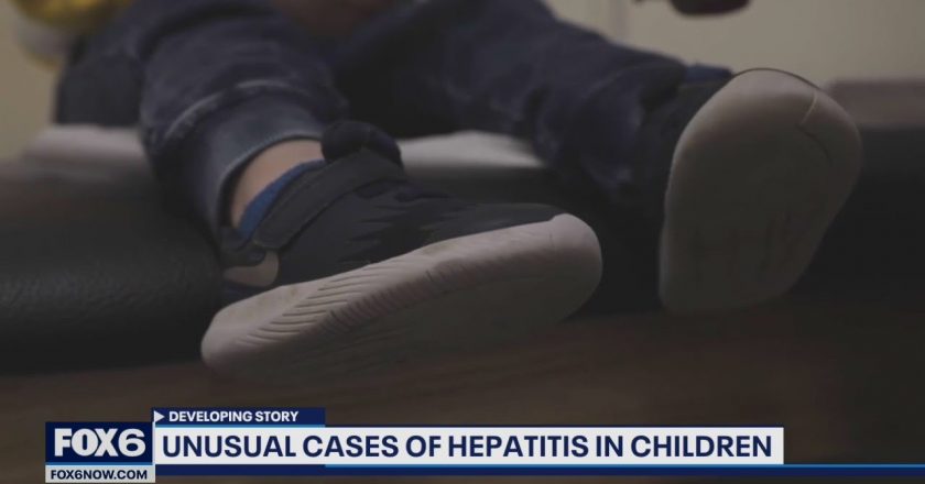 Wisconsin health officials investigate child hepatitis cases | FOX6 News Milwaukee – FOX6 News Milwaukee