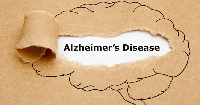 Alzheimers biomarker sparks warning about brain-boosting serine supplements – Study Finds