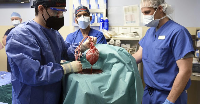 Virus found in pig heart used in human transplant – The Associated Press – en Español