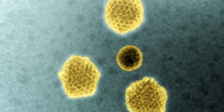 450 cases, 11 dead worldwide in growing child hepatitis mystery – Ars Technica