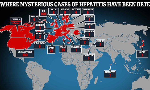 At least 12 children have now died from mystery hepatitis and more than 450 have fallen ill – Daily Mail